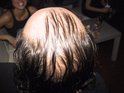 100-0033_IMG.JPG